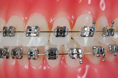 Photo: Dr Richard Pepperell Orthodontics
